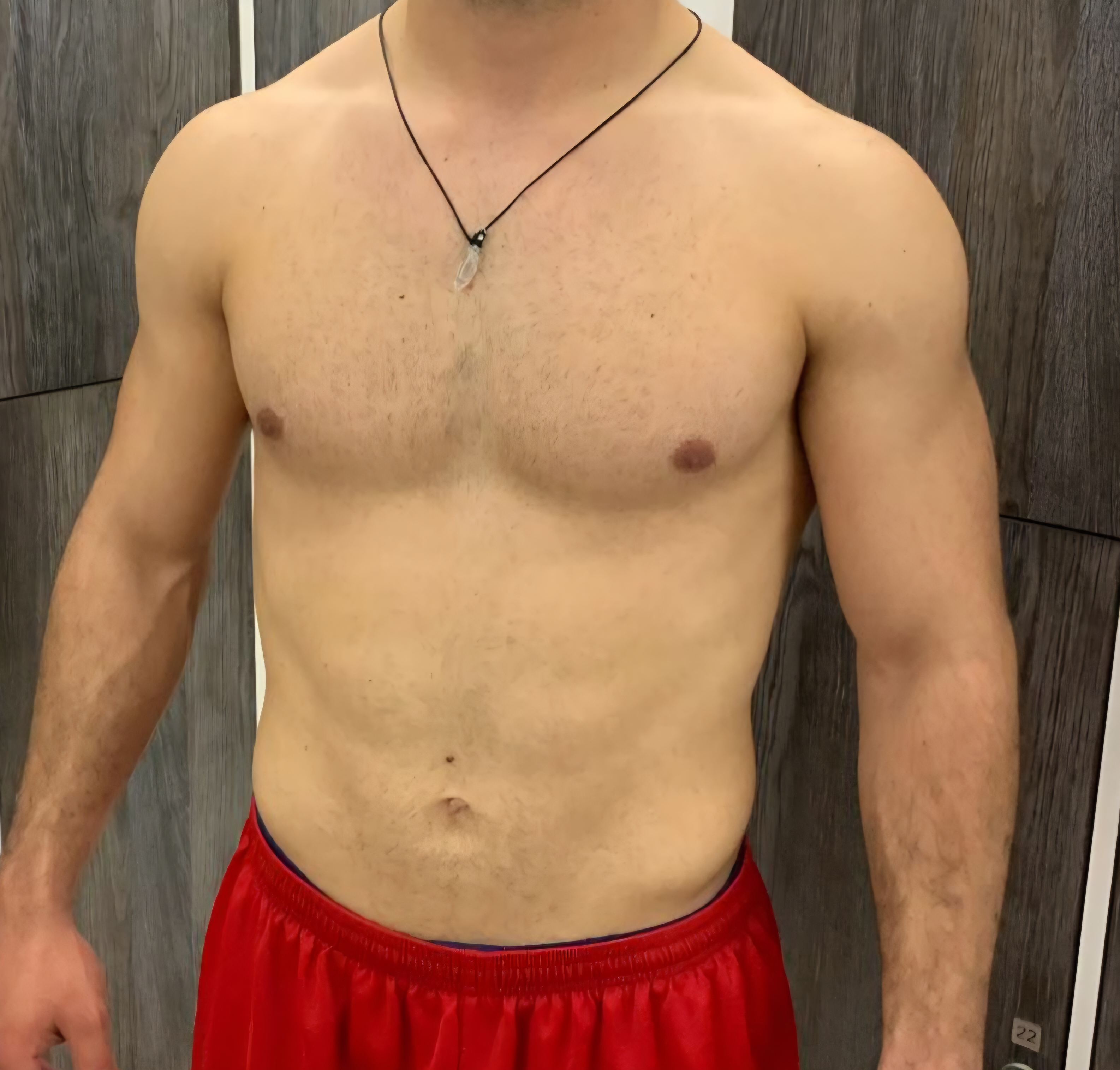 Vorher-Bild Transformation Kunde 3